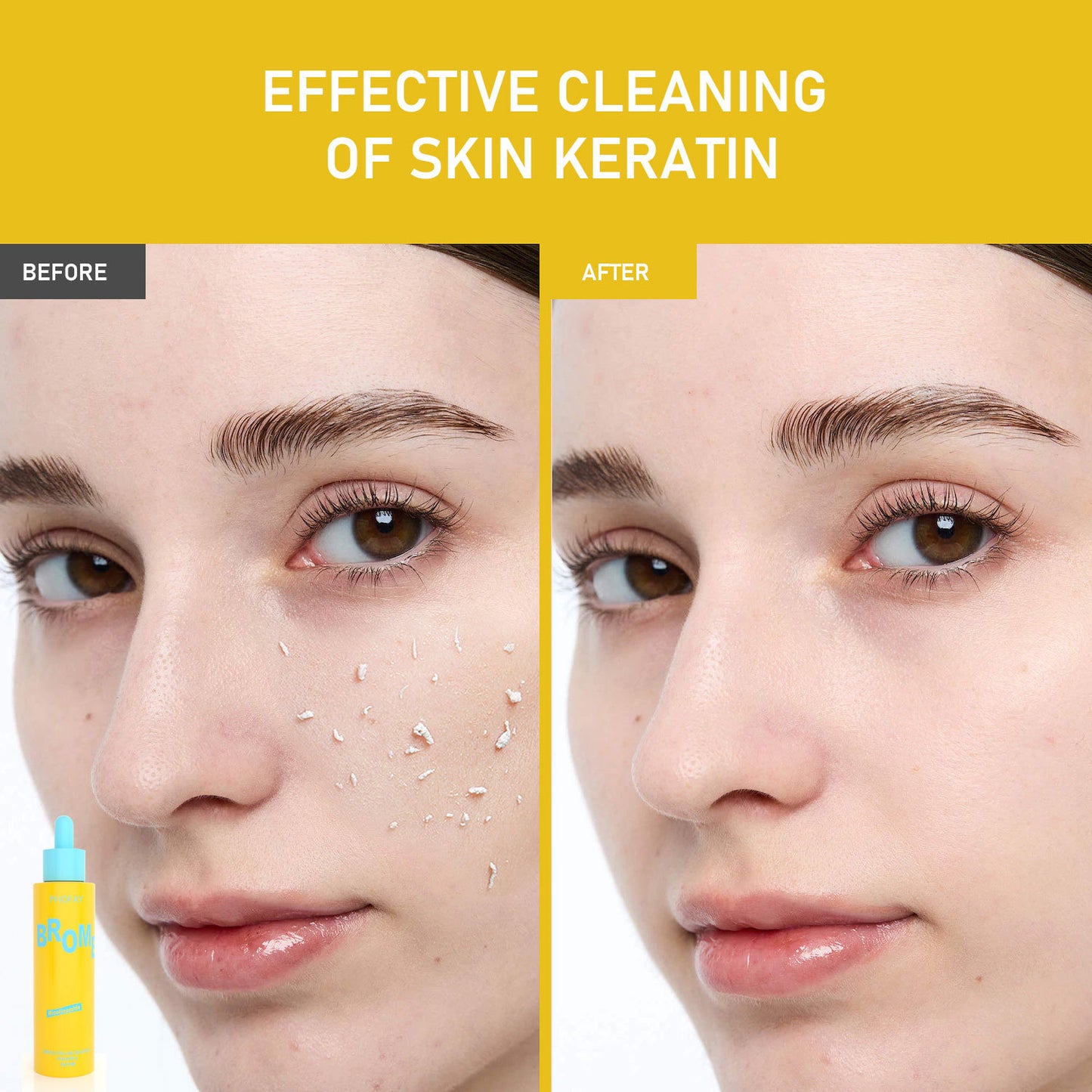 Phofay Exfoliating Set