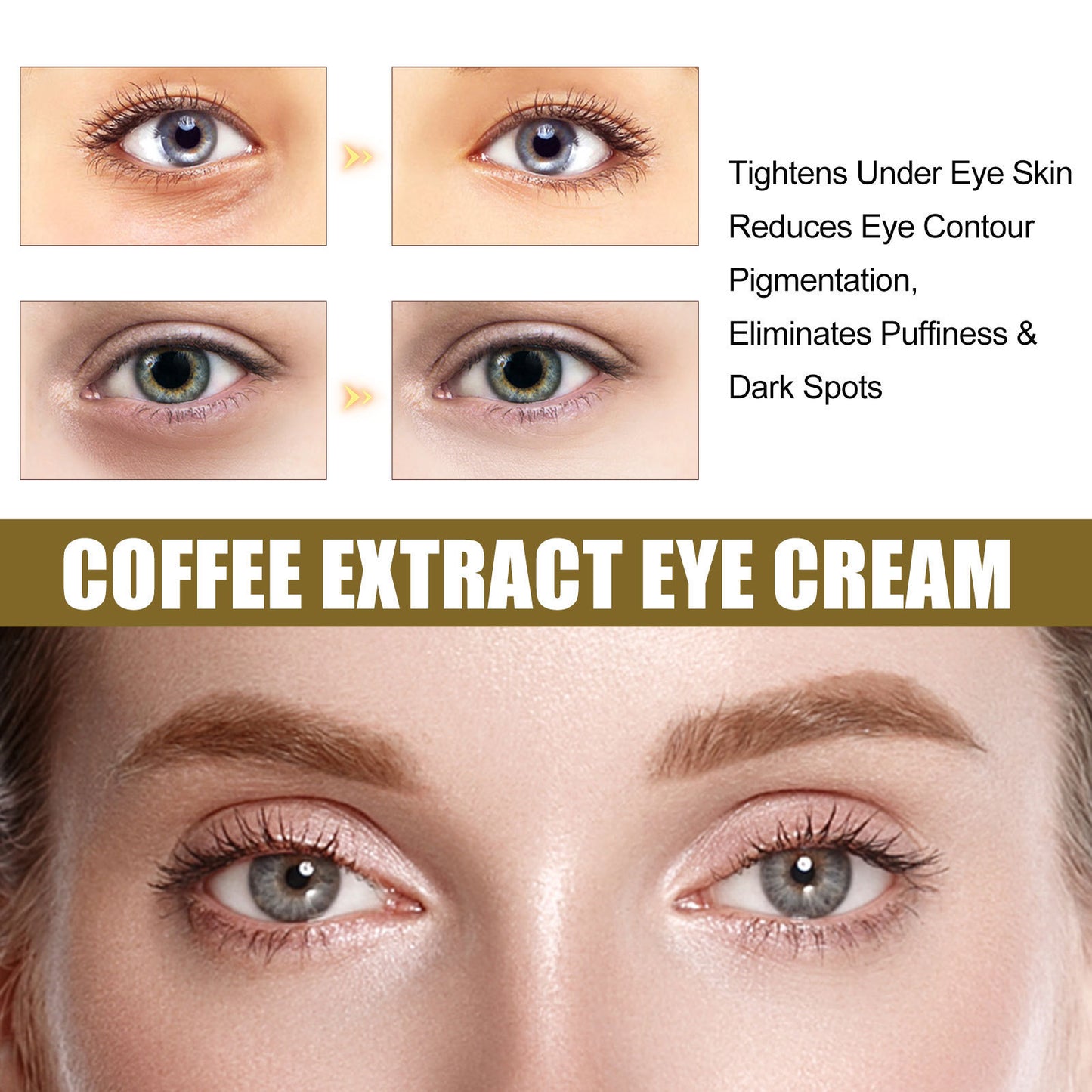 Fading Wrinkle Dark Circles Tighten The Skin Around The Eyes Eye Moisturizing Care