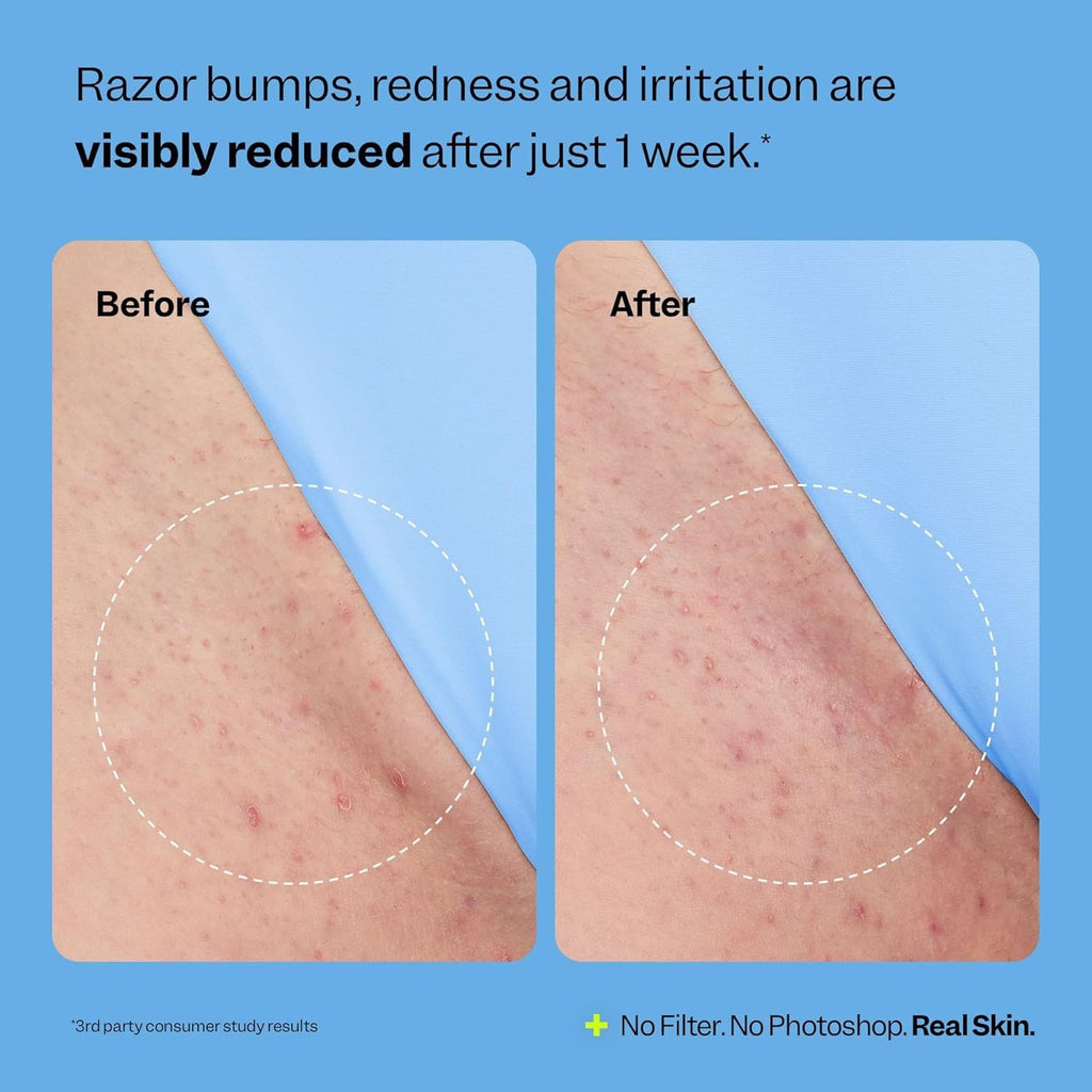 Body Care Ball Hair Removal And Relaxation Essence Moisturizing Refreshing Smooth Skin Gentle